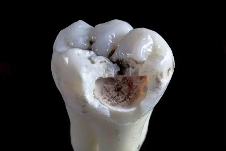 Connection Between Oral Health and Overall Wellness